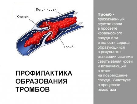 Что Можно Купить В Турции От Тромбообразования